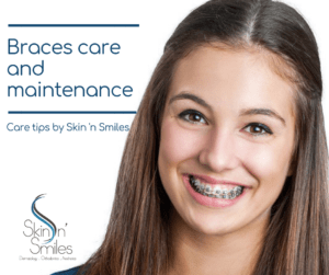 Taking care of your braces and teeth