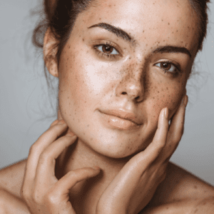 Get rid of pigmentation with skin n' smiles